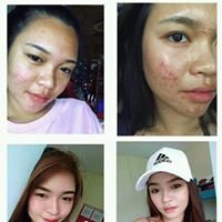 Luxxe White Legazpi Official - Bicol Branch chat bot